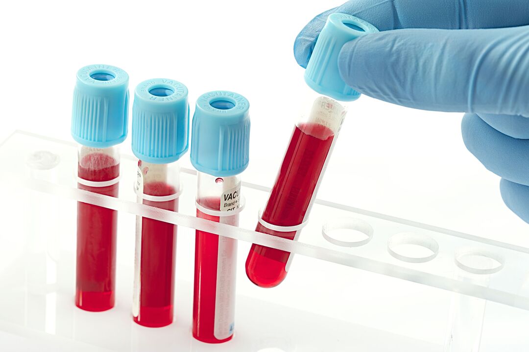Bluttest zur Diagnose des humanen Papillomavirus